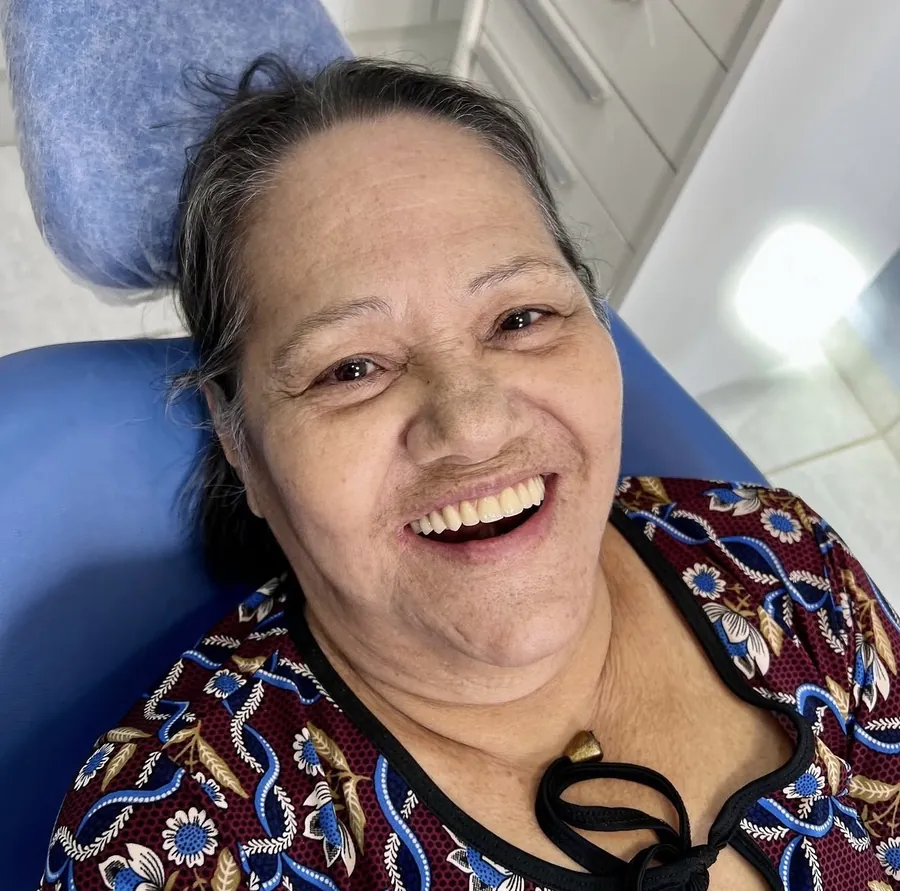 Sirlei, undefined anos — paciente da NOA Odontologia em Penápolis após PRÓTESE PROTOCOLO
